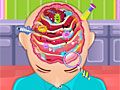 Операция на головном мозге